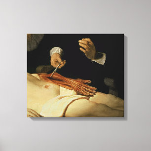 Die Anatomie-Lektion von Dr. Nicolaes Tulp, 1632 Leinwanddruck