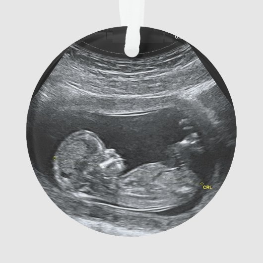 Die erste Weihnacht des Babys Ornament (Rückseite)