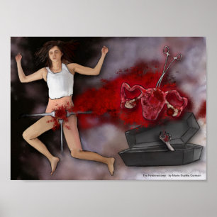 Die Hysterektomie Poster