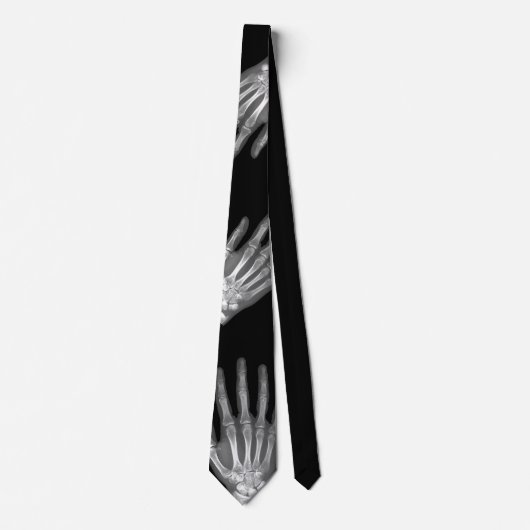 Die Krawatte der Skeleton Handröntgenstrahl-Männer (Vorderseite)