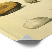 Die menschliche Schädelspinne Medizinische Anatomi Poster (Ecke)