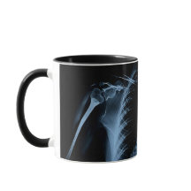 Die Röntgenaufnahme