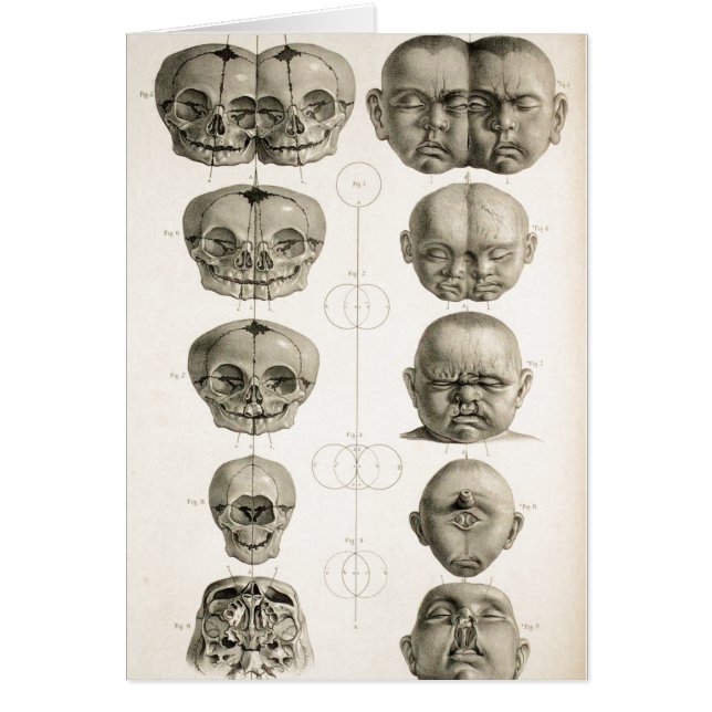 Die sonderbaren (Vorne)