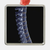 Die vertebrale Spalte 3 Silbernes Ornament (Vorne)
