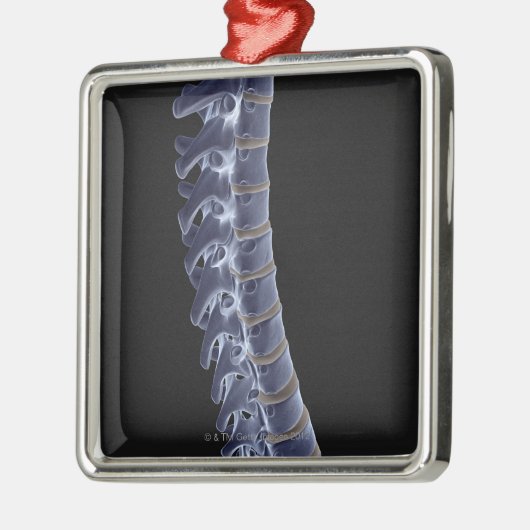 Die vertebrale Spalte 3 Silbernes Ornament (Links)