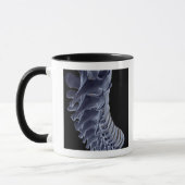 Die vertebrale Spalte Tasse (Links)