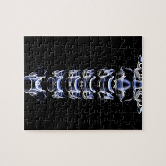 Die Zervikalwirbel Puzzle (Horizontal)