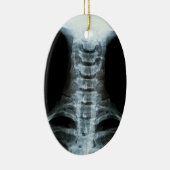 Digital-Röntgenstrahl-Kunst (Gewohnheits-hinterer Keramik Ornament (Rechts)