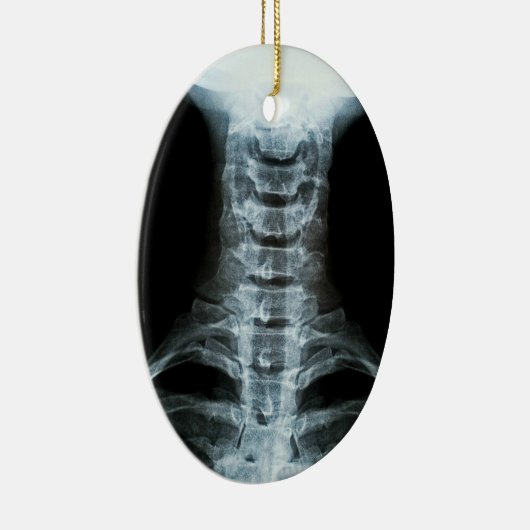 Digital-Röntgenstrahl-Kunst (Gewohnheits-hinterer Keramik Ornament (Rechts)