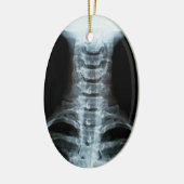 Digital-Röntgenstrahl-Kunst (Gewohnheits-hinterer Keramik Ornament (Links)