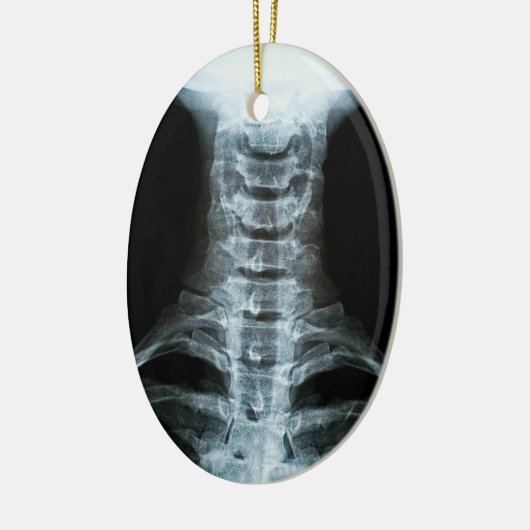 Digital-Röntgenstrahl-Kunst (Gewohnheits-hinterer Keramik Ornament (Links)