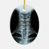 Digital-Röntgenstrahl-Kunst (Gewohnheits-hinterer Keramik Ornament (Vorne)