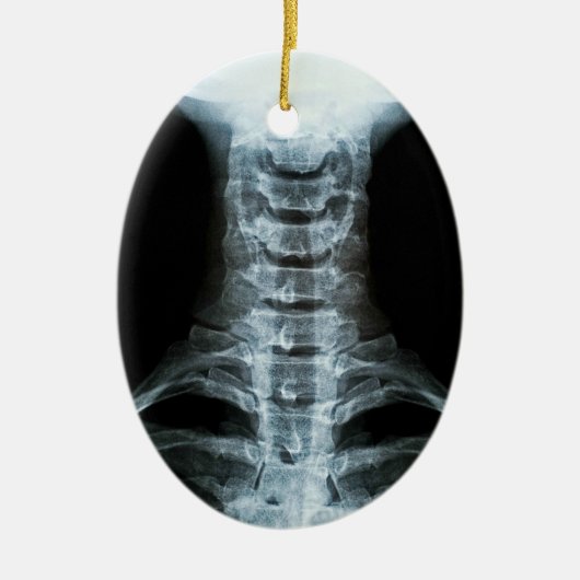 Digital-Röntgenstrahl-Kunst (Gewohnheits-hinterer Keramik Ornament (Vorne)