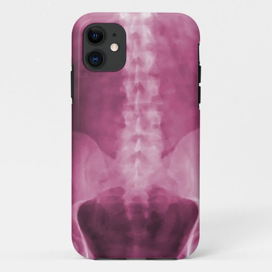 Digital-Röntgenstrahl-Kunst iPhone 5 Fall Case-Mate iPhone Hülle (Rückseite)