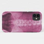 Digital-Röntgenstrahl-Kunst iPhone 5 Fall Case-Mate iPhone Hülle (Rückseite (Horizontal))