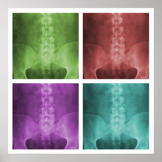 Digital X-Ray Pop Art Square Poster (Vorne)