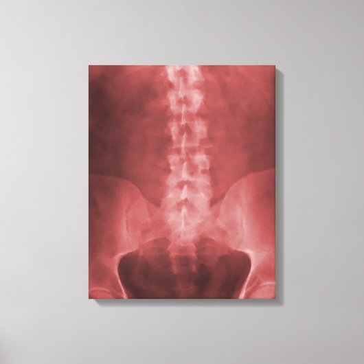 Digitale Ray Art Wrapped Canvas Leinwanddruck (Vorderseite)