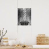 Digitale Röntgenkunstausdrucke Poster (Küche)