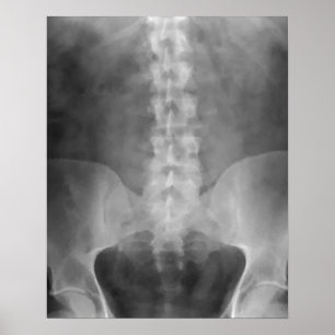 Digitale X-Ray Art Print Poster