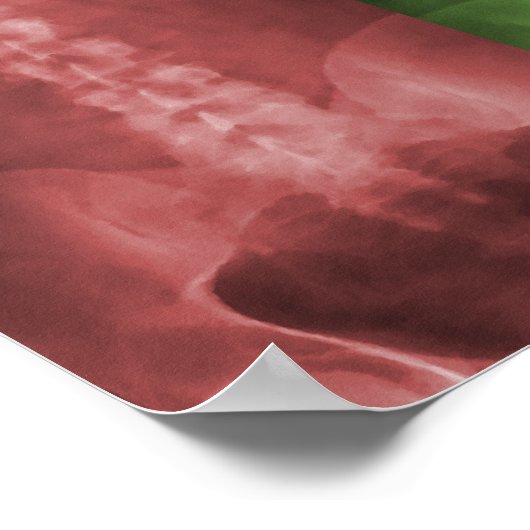 Digitales X-Ray Art Leinwand Poster (Ecke)