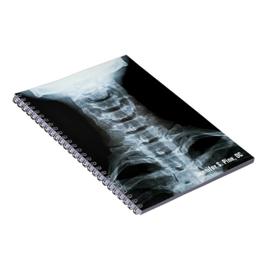 Digitales X-Ray-Personalisiert-Notebook Notizblock (Rechte Seite)