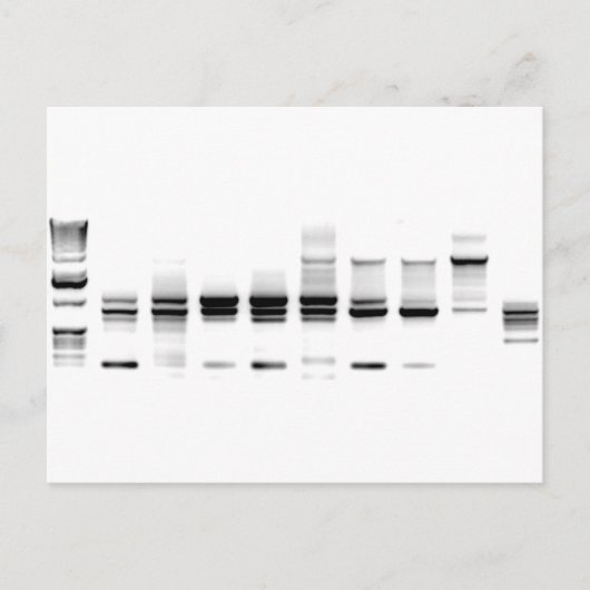 DNA Gel Postkarte (Vorderseite)