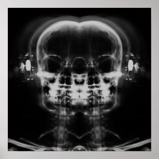 Doppel-X-Ray-Skulls mit Kopfhörern - B&W Poster