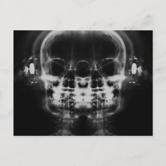 Doppel-X-Ray-Skulls mit Kopfhörern - B&W Postkarte