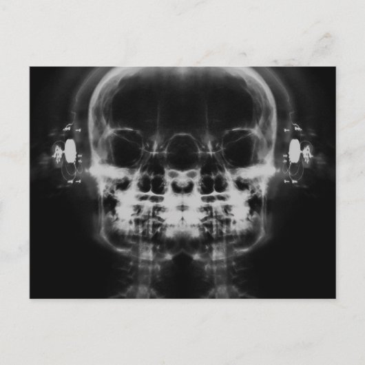 Doppel-X-Ray-Skulls mit Kopfhörern - B&W Postkarte (Vorderseite)