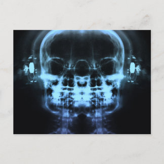 Doppel-X-Ray-Skulls mit Kopfhörern - Blau Postkarte