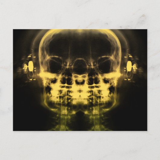 Doppel-X-Ray-Skulls mit Kopfhörern - Gelb Postkarte (Vorderseite)