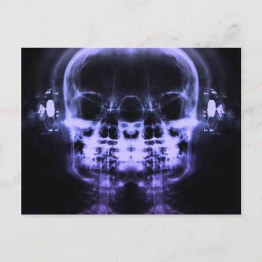 Doppel-X-Ray-Skulls mit Kopfhörern - Lila Postkarte (Vorderseite)