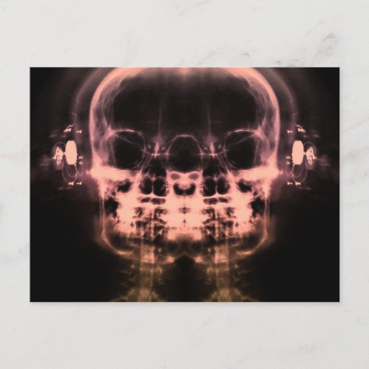 Doppel-X-Ray-Skulls mit Kopfhörern - Orange Postkarte (Vorderseite)