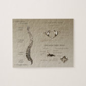 Dorn Puzzle (Horizontal)