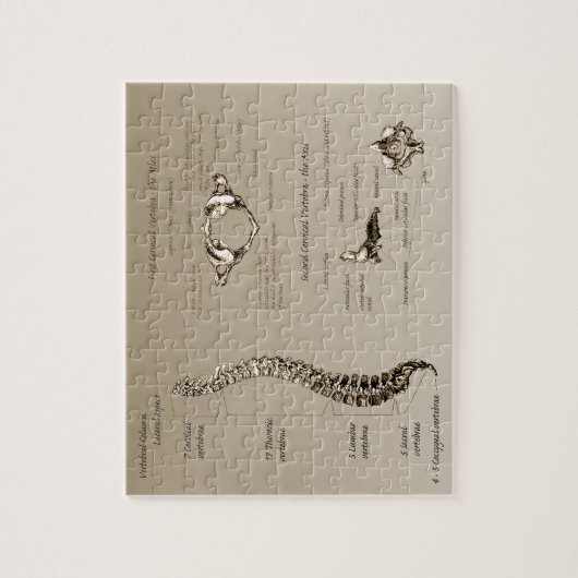 Dorn Puzzle (Vertikal)