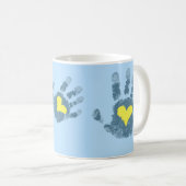 Down-Syndrom Bewusstsein Kaffeetasse (VorderseiteRechts)