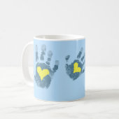 Down-Syndrom Bewusstsein Kaffeetasse (Vorderseite Links)