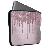 Drilling Girly Glitzer | Dusty Mauve Pink Shimmer Laptopschutzhülle (Vorne Rechts)