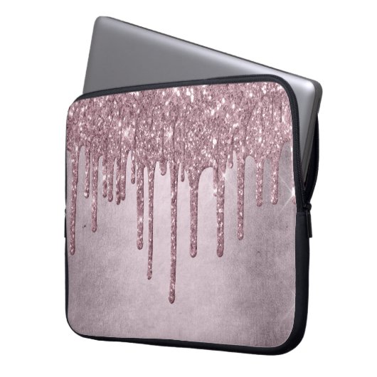 Drilling Girly Glitzer | Dusty Mauve Pink Shimmer Laptopschutzhülle (Vorderseite Links)