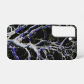 Dunkle Seite 5 sgcna Samsung Galaxy Hülle (Rückseite (Horizontal))