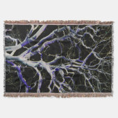 Dunkle Seite 5 tbcnm Decke (Vorderseite)