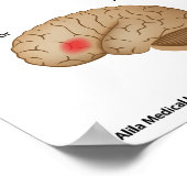 Dyslexie Gehirnaktivität Poster (Ecke)