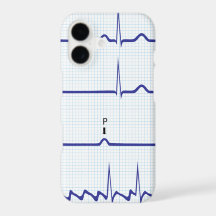 ECG/EKG iPhone Fall