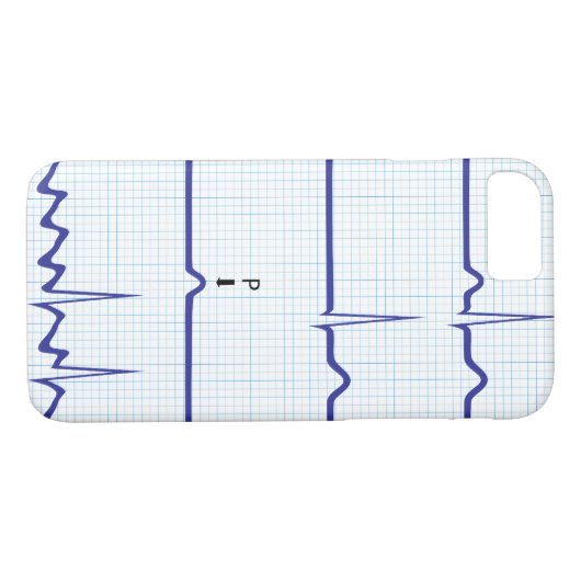 ECG/EKG iPhone Fall Case-Mate iPhone Hülle (Rückseite (Horizontal))