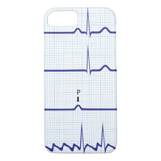 ECG/EKG iPhone Fall Case-Mate iPhone Hülle (Rückseite)