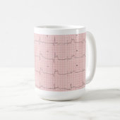 ECG Tasse (VorderseiteRechts)