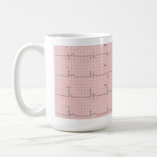 ECG Tasse (Links)