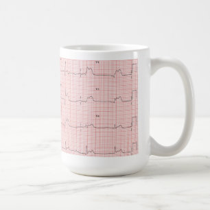 ECG Tasse