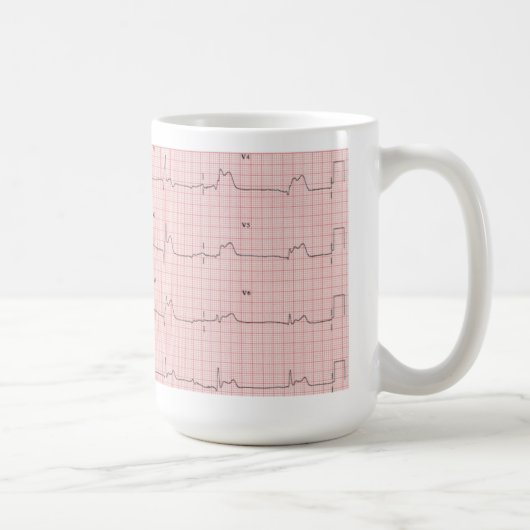 ECG Tasse (Rechts)