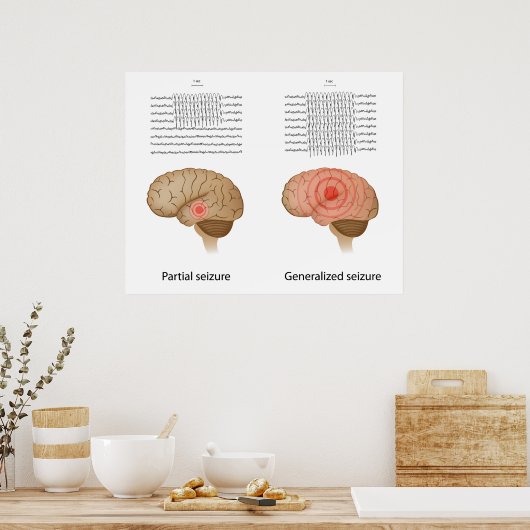 EEG bei partieller und genereller Epilepsie Poster (Küche)